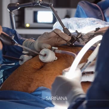 Slider image (8) Dr. Marco Sariñana - Bariatric Surgeon in Mexico